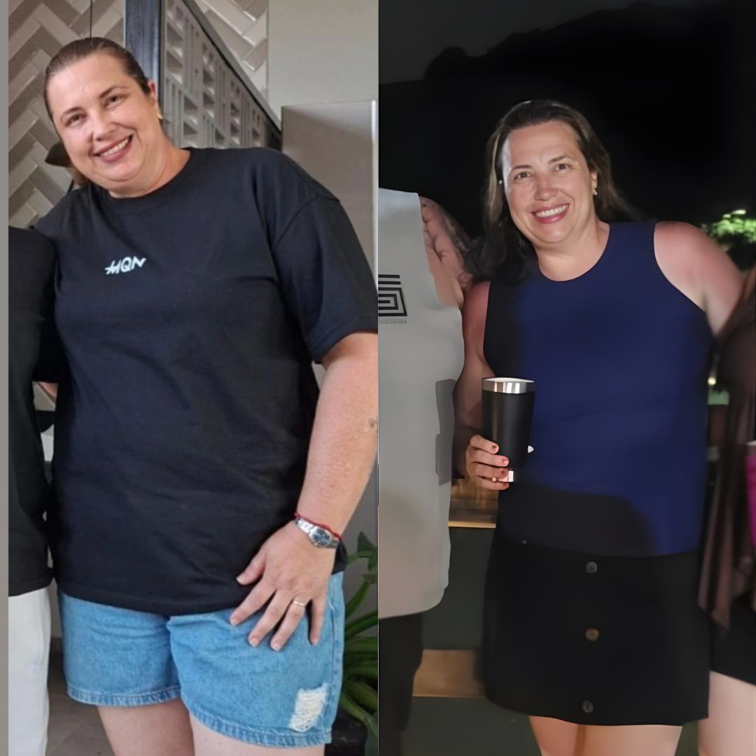 Transformação Antes e Depois 3